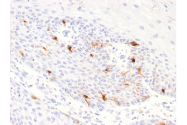 Recombinant Tyrosinase-Related Protein 1 antibody  (AA 257-377)