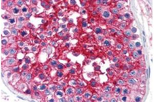 Human Testis (formalin-fixed, paraffin-embedded) stained with BSG antibody ABIN239809 at 10 ug/ml followed by biotinylated anti-mouse IgG secondary antibody ABIN481714, alkaline phosphatase-streptavidin and chromogen. (CD147 antibody)
