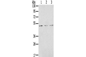 Western Blotting (WB) image for anti-Forkhead Box G1 (FOXG1) antibody (ABIN2431348) (FOXG1 antibody)
