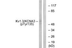 Western blot analysis of extracts from Jurkat cells treated with starved 24h, using Kv1. (KCNA3 antibody  (pTyr135))