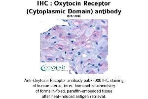 Image no. 1 for anti-Oxytocin Receptor (OXTR) (3rd Cytoplasmic Domain) antibody (ABIN1737737)