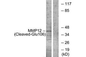Western blot analysis of extracts from NIH-3T3 cells, treated with etoposide 25uM 1h, using MMP12 (Cleaved-Glu106) Antibody.