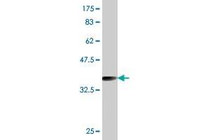 Western Blot detection against Immunogen (36. (RAB27A antibody  (AA 122-221))