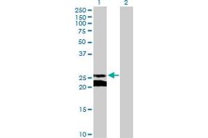Western Blotting (WB) image for anti-Gap Junction Protein, beta 5, 31,1kDa (GJB5) (AA 1-273) antibody (ABIN516039)
