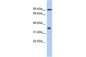 WB Suggested Anti-C6orf154 Antibody Titration: 0. (C6orf154 antibody  (Middle Region))