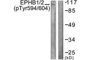 Western blot analysis of extracts from HepG2 cells, using EPHB1/2 (Phospho-Tyr594/604) Antibody. (EPHB1/2 antibody  (pTyr594))