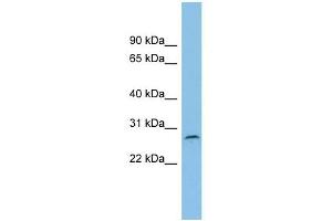 C1orf104 antibody used at 1 ug/ml to detect target protein.