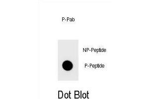 Dot blot analysis of Phospho-TOPBP1- Antibody Phospho-specific Pab (ABIN1539690 and ABIN2839840) on nitrocellulose membrane. (TOPBP1 antibody  (pSer1159))