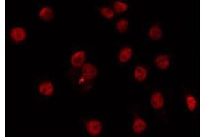 ABIN6266721 staining Hela by IF/ICC. (Musculin antibody  (Internal Region))
