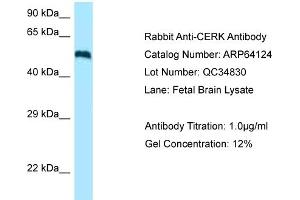 Western Blotting (WB) image for anti-Ceramide Kinase (CERK) (C-Term) antibody (ABIN2789738) (CERK antibody  (C-Term))