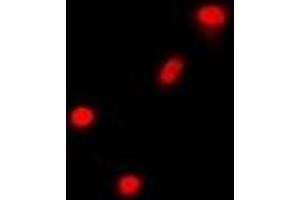 Immunofluorescent analysis of Cbl-3 staining in A549 cells. (CBLC antibody)