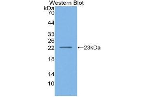Western blot analysis of the recombinant protein. (Lipase A antibody  (AA 32-201))