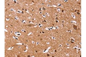 The image on the left is immunohistochemistry of paraffin-embedded Human brain tissue using ABIN7128938(CHRM1 Antibody) at dilution 1/20, on the right is treated with fusion protein. (CHRM1 antibody)
