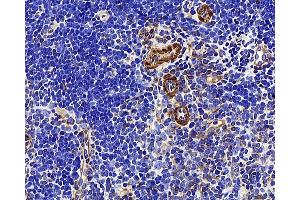 Immunohistochemistry analysis of paraffin-embedded mouse thymus using LDLR Polyclonal Antibody at dilution of 1:300. (LDLR antibody)