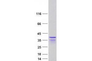 Validation with Western Blot (PPHLN1 Protein (Transcript Variant 8) (Myc-DYKDDDDK Tag))