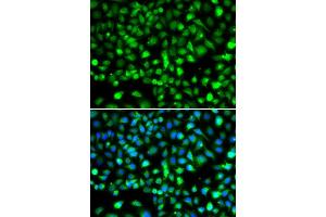 Immunofluorescence analysis of MCF-7 cells using SMYD1 antibody (ABIN6128707, ABIN6148163, ABIN6148165 and ABIN6219496). (SMYD1 antibody  (AA 1-350))