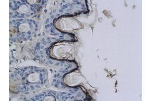Formalin-fixed and paraffin embedded rat skin labeled with Anti-CNR2/CB2 Polyclonal Antibody, Unconjugated (ABIN680168) at 1:200 followed by conjugation to the secondary antibody and DAB staining. (CNR2 antibody  (AA 251-350))