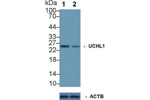 Western Blotting (WB) image for anti-Ubiquitin Carboxyl-terminal Esterase L1 (Ubiquitin Thiolesterase) (UCHL1) (AA 2-223) antibody (ABIN7436393)