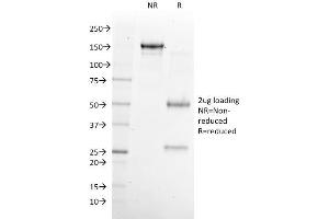 SDS-PAGE Analysis Purified NKX6. (NKX6-1 antibody)