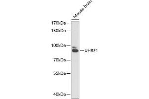 Western blot analysis of extracts of mouse brain, using UHRF1 antibody (ABIN6130753, ABIN6149909, ABIN6149910 and ABIN6216275) at 1:1000 dilution. (UHRF1 antibody  (AA 139-298))