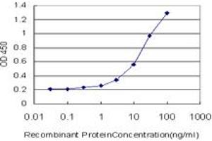 Detection limit for recombinant GST tagged LRAT is approximately 0. (LRAT antibody  (AA 1-230))