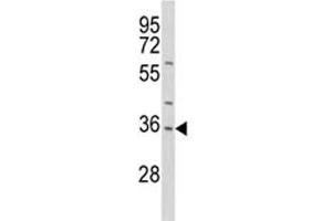 Western Blotting (WB) image for anti-Interleukin 1 alpha (IL1A) (AA 177-206) antibody (ABIN3031433)