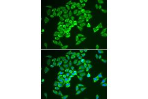Immunofluorescence analysis of A549 cell using KEAP1 antibody. (KEAP1 antibody  (AA 325-624))