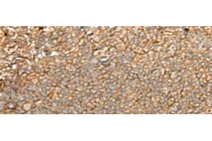 Immunohistochemistry (Paraffin-embedded Sections) (IHC (p)) image for anti-Guanine Nucleotide Binding Protein (G Protein), gamma Transducing Activity Polypeptide 2 (GNGT2) antibody (ABIN7245212)