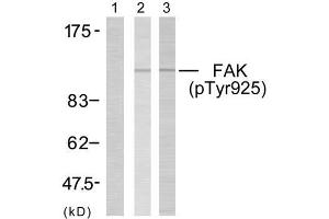 Western blot analysis of extracts using FAK (phospho- Tyr925) antibody (E011123). (FAK antibody  (pTyr925))