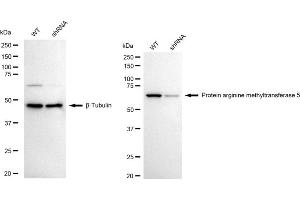 Western blotting analysis using protein arginine methyltransferase 5 antibody (ABIN7799971). (Recombinant PRMT5 antibody)
