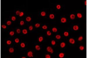 ABIN6266630 staining HepG2 by IF/ICC. (Retinoic Acid Receptor beta antibody  (Internal Region))