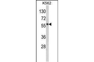 Western blot analysis of hMMP19-R359 in K562 cell line lysates (35ug/lane)