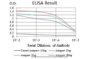 Black line: Control Antigen (100 ng), Purple line: Antigen(10 ng), Blue line: Antigen (50 ng), Red line: Antigen (100 ng), (ASS1 antibody)