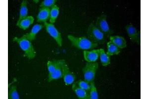Detection of NT5C3 in Human Hela Cell using Polyclonal Antibody to 5'-Nucleotidase, Cytosolic III (NT5C3) (NT5C3 antibody  (AA 52-336))