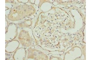 Immunohistochemistry of paraffin-embedded human kidney tissue using ABIN7151945 at dilution of 1:100 (EPM2AIP1 antibody  (AA 251-607))