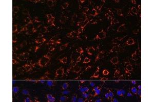 Immunofluorescence analysis of C6 cells using TOM20 Polyclonal Antibody at dilution of 1:100. (TOMM20 antibody)