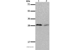 Western blot analysis of Mouse brain and kidney tissue, using KLK7 Polyclonal Antibody at dilution of 1:600 (Kallikrein 7 antibody)
