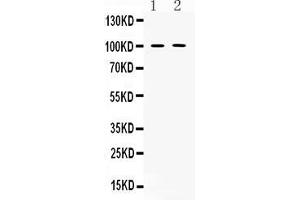 Western blot analysis of PDE5A expression in rat lung extract ( Lane 1) and PANC-1 whole cell lysates( Lane 2).