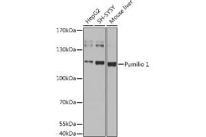 Western blot analysis of extracts of various cell lines, using Pumilio 1 antibody (ABIN6132539, ABIN6146494, ABIN6146496 and ABIN6217367) at 1:1000 dilution. (PUM1 antibody  (AA 1-130))