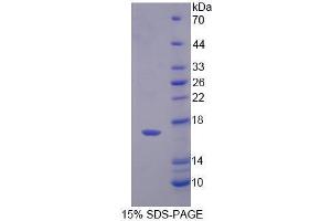 Image no. 1 for Profilin 4 (PFN4) (AA 1-125) protein (His tag) (ABIN5665241)