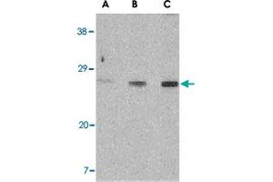 Western blot analysis of XBP1 in PC-3 cell lysate with XBP1 polyclonal antibody  at (A) 0. (XBP1 antibody  (C-Term))