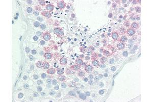 Anti-TG737 / IFT88 antibody IHC staining of human testis. (IFT88 antibody  (AA 791-820))