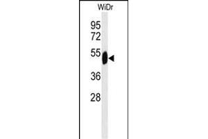 Western blot analysis of SETD6 Antibody (C-term) (ABIN651041 and ABIN2840045) in WiDr cell line lysates (35 μg/lane). (SETD6 antibody  (C-Term))