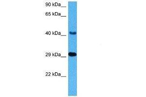 Western Blotting (WB) image for anti-Cathepsin D (CTSD) (C-Term) antibody (ABIN2776841)
