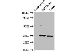 Immunoprecipitating MAGEA1 in Hela whole cell lysate Lane 1: Rabbit control IgG instead of ABIN7159251 in Hela whole cell lysate. (MAGEA1 antibody  (AA 1-309))