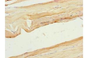 Immunohistochemistry of paraffin-embedded human skeletal muscle tissue using ABIN7175917 at dilution of 1:100