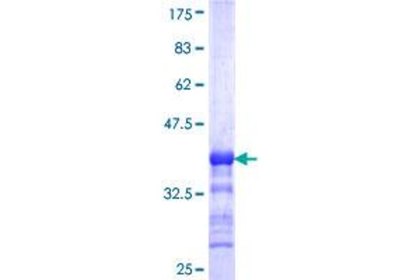 IP6K1 Protein (AA 182-275) (GST tag)