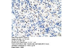 Rabbit Anti-DDX47 Antibody  Paraffin Embedded Tissue: Human Liver Cellular Data: Hepatocytes Antibody Concentration: 4. (DDX47 antibody  (C-Term))