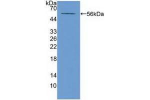 Western blot analysis of recombinant Mouse ABCA13. (ABCA13 antibody  (AA 4692-4931))