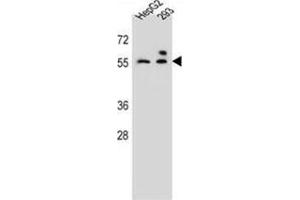 ZFP91 Antibody (Center) (AP54647PU-N ) western blot analysis in HepG2,293 cell line lysates (35 µg/lane).